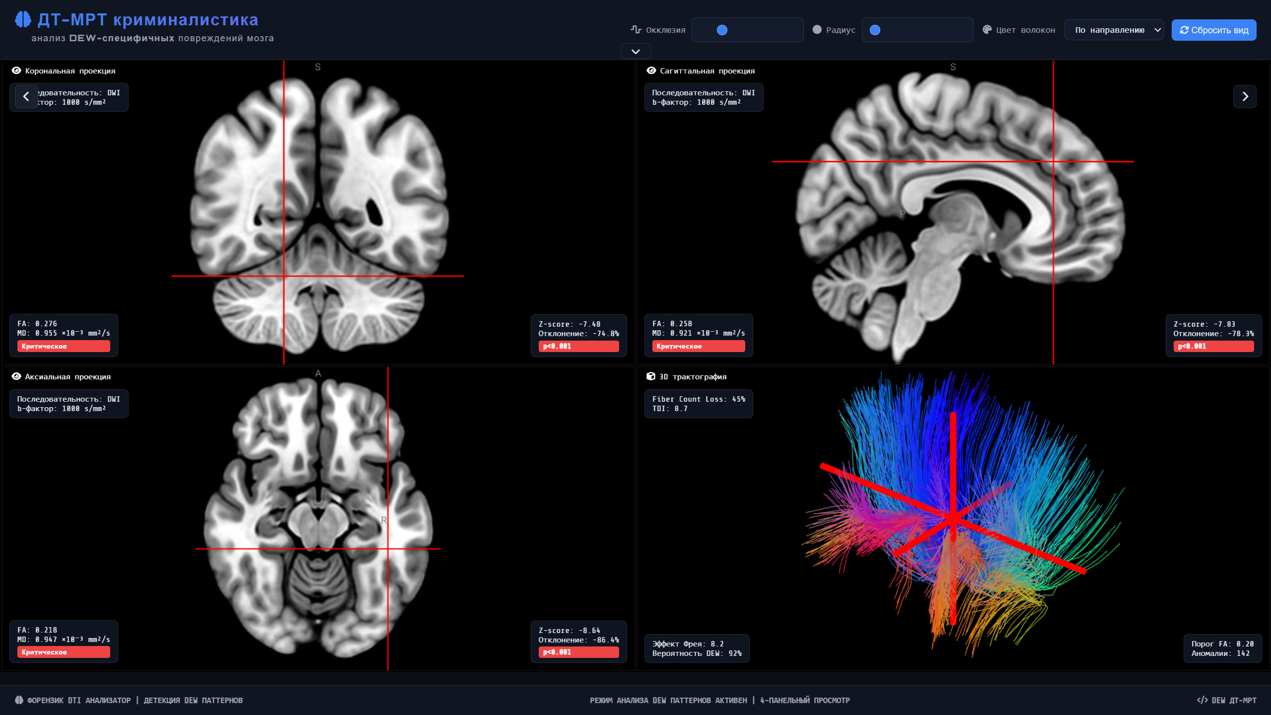 ДТ-МРТ результаты